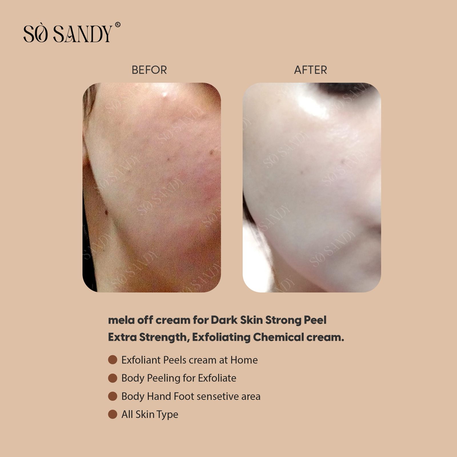 سو ساندي ميلا اوف كريم تقشير 15 جرام