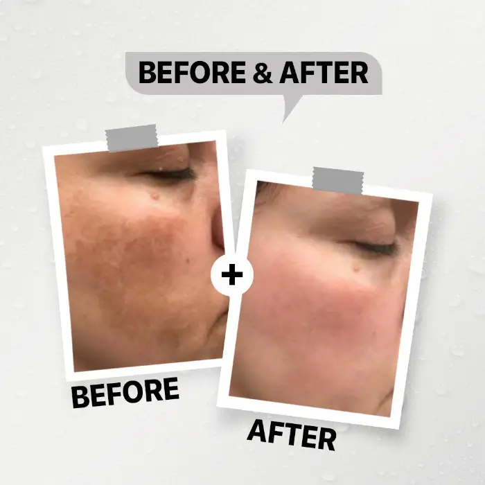 Daky-Whitening-Cream4 داكي كريم التفتيح والبقع الداكنة 60 جرام