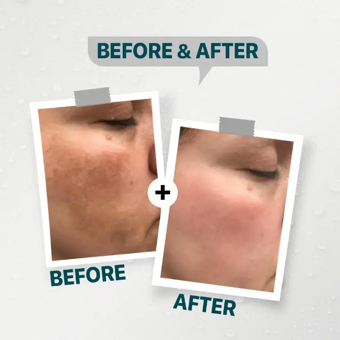 Daky-night-whitening-cream داكى نايت للتفتيح كريم 50 جرام