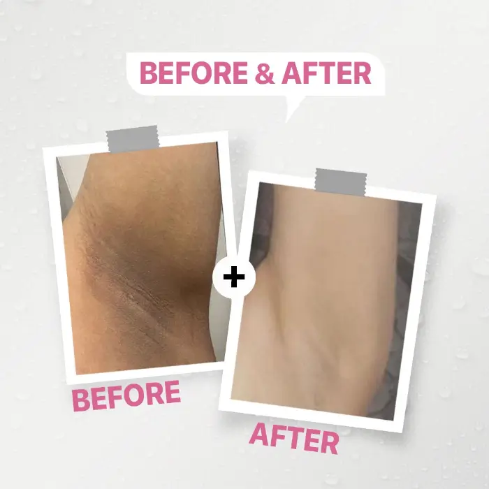 كريم تبييض داكي للمنطقة الحساسة 50 جرام