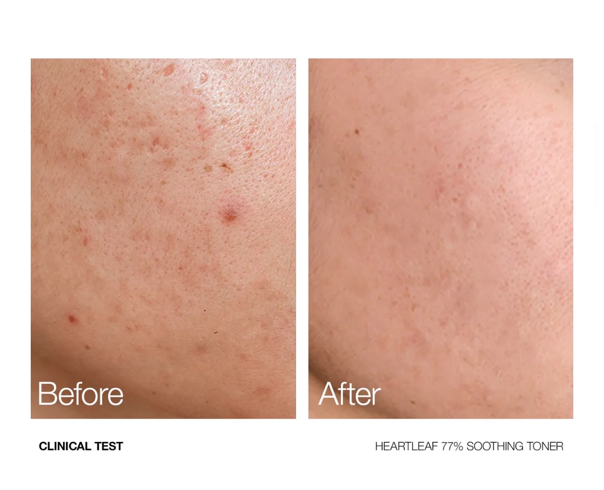 تونر انوا 77% 250 مل